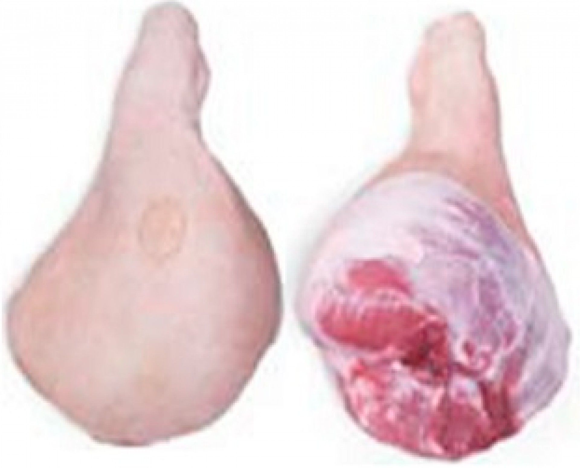 PERNIL CONG. MONTINO KG.